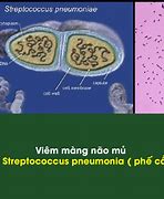 Viêm Phổi Và Viêm Màng Não Mủ